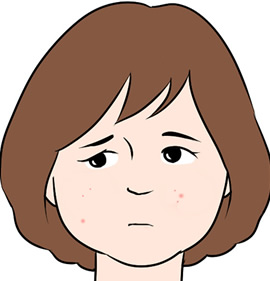 日常的な肌トラブル